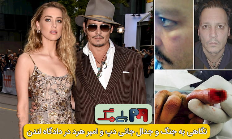 قطع شدن انگشتان جانی دپ توسط امبر هرد (همسر سابق جانی دپ)